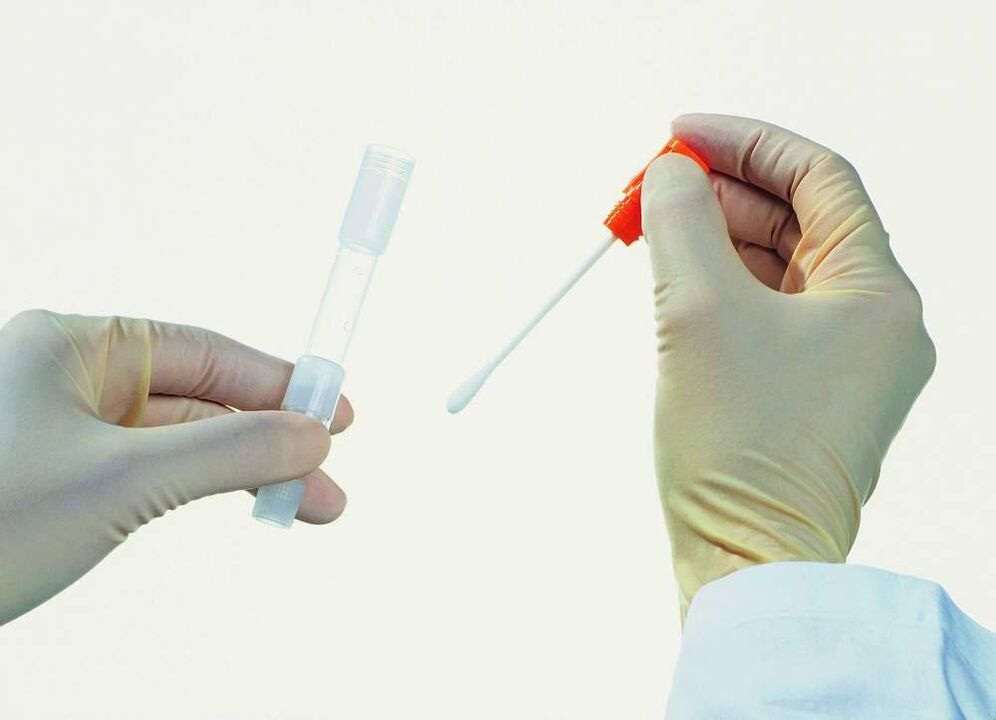 Analizės rinkinys, skirtas nustatyti lėtinį prostatitą