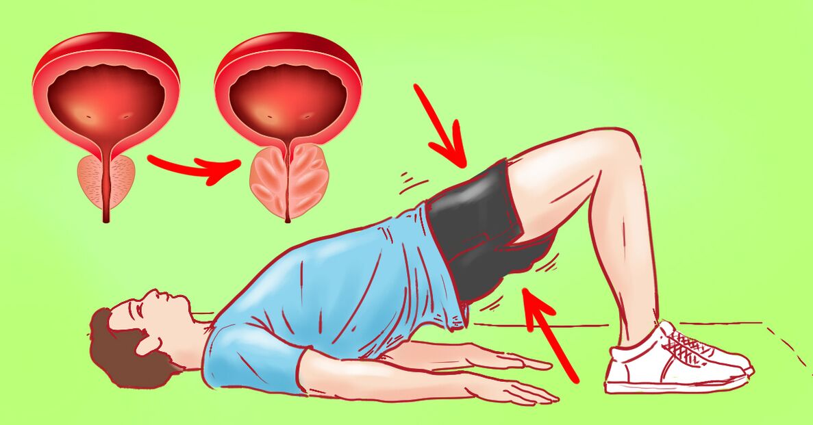 Terapiniai lėtinio prostatito pratimai